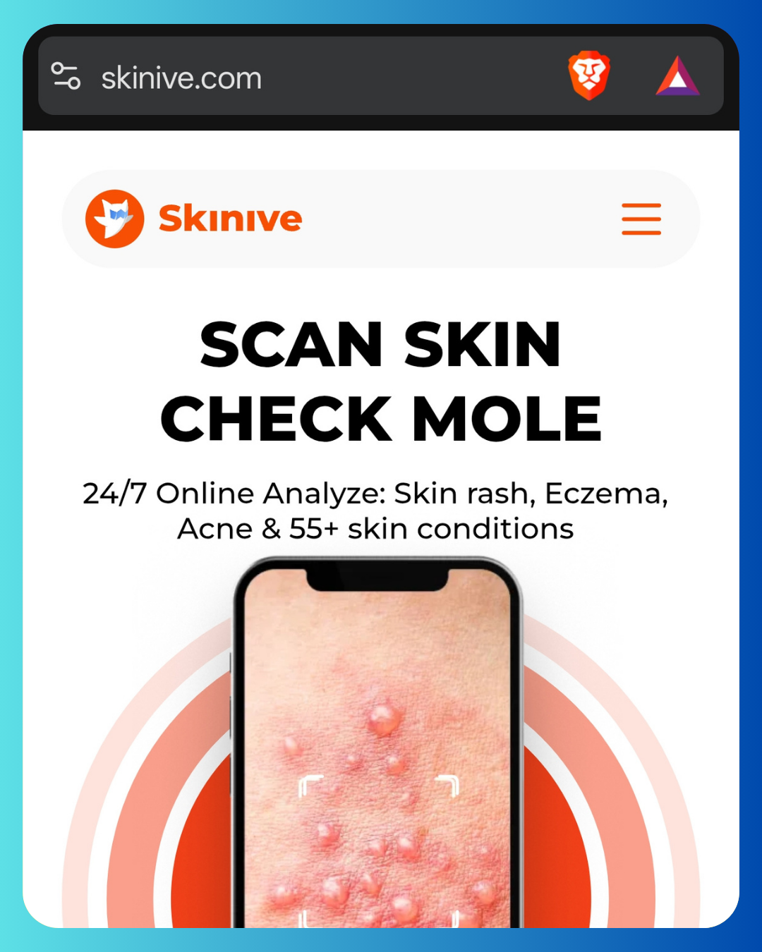 Skinive