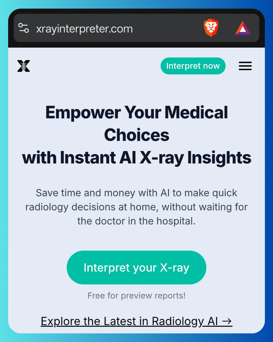 X-ray Interpreter